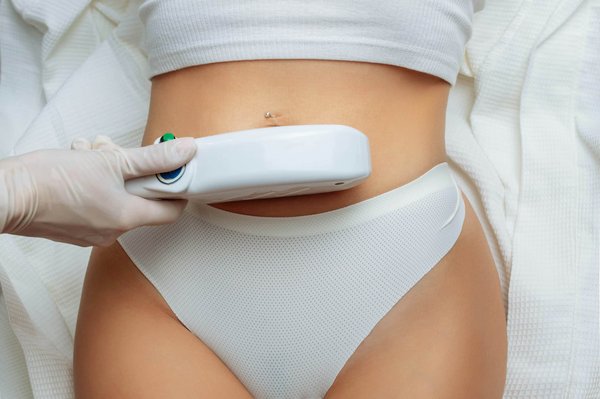 Guide 2024 : choisissez le meilleur épilateur lumière pulsée